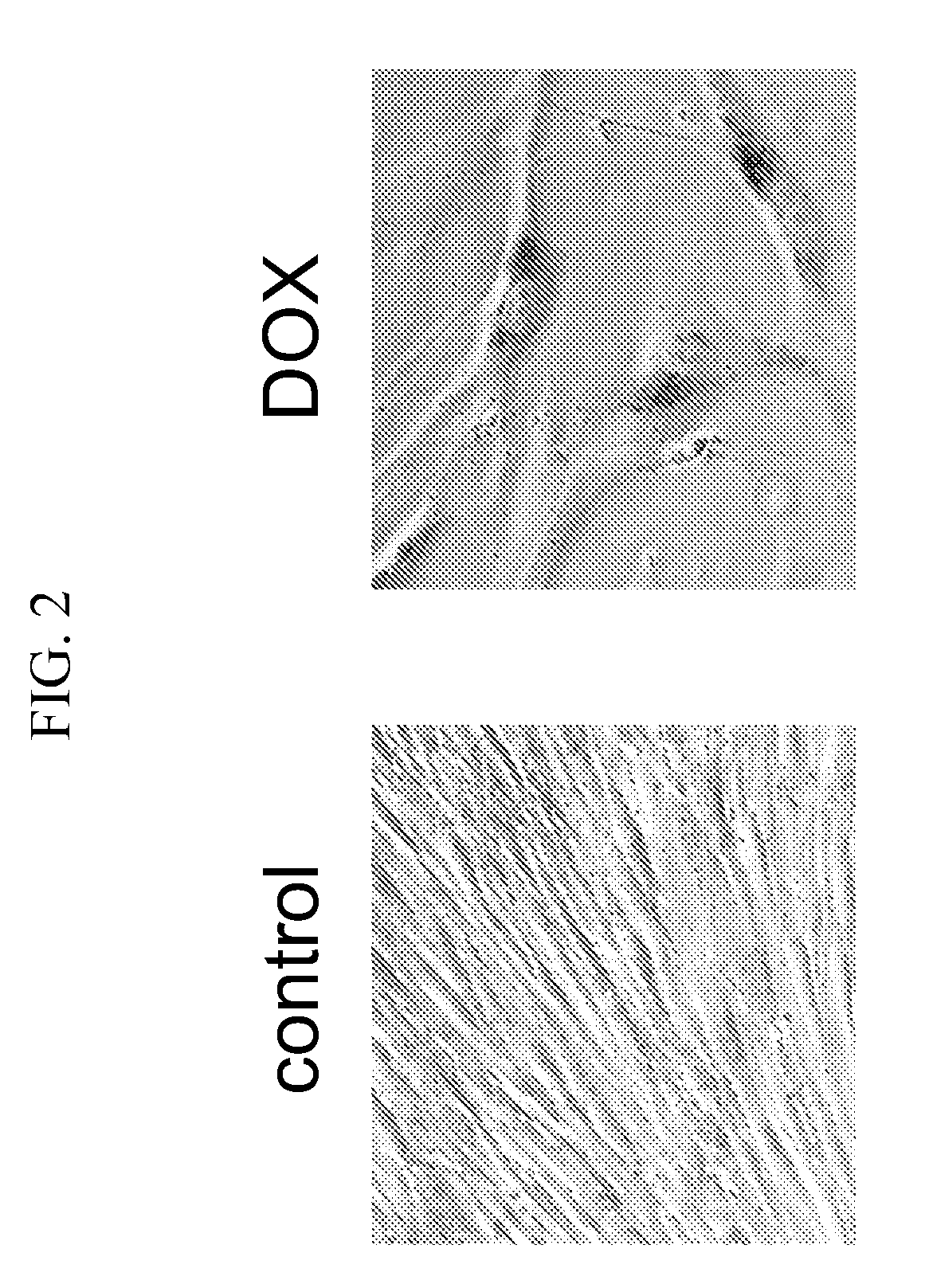 Methods and compositions for preventing or treating age-related diseases
