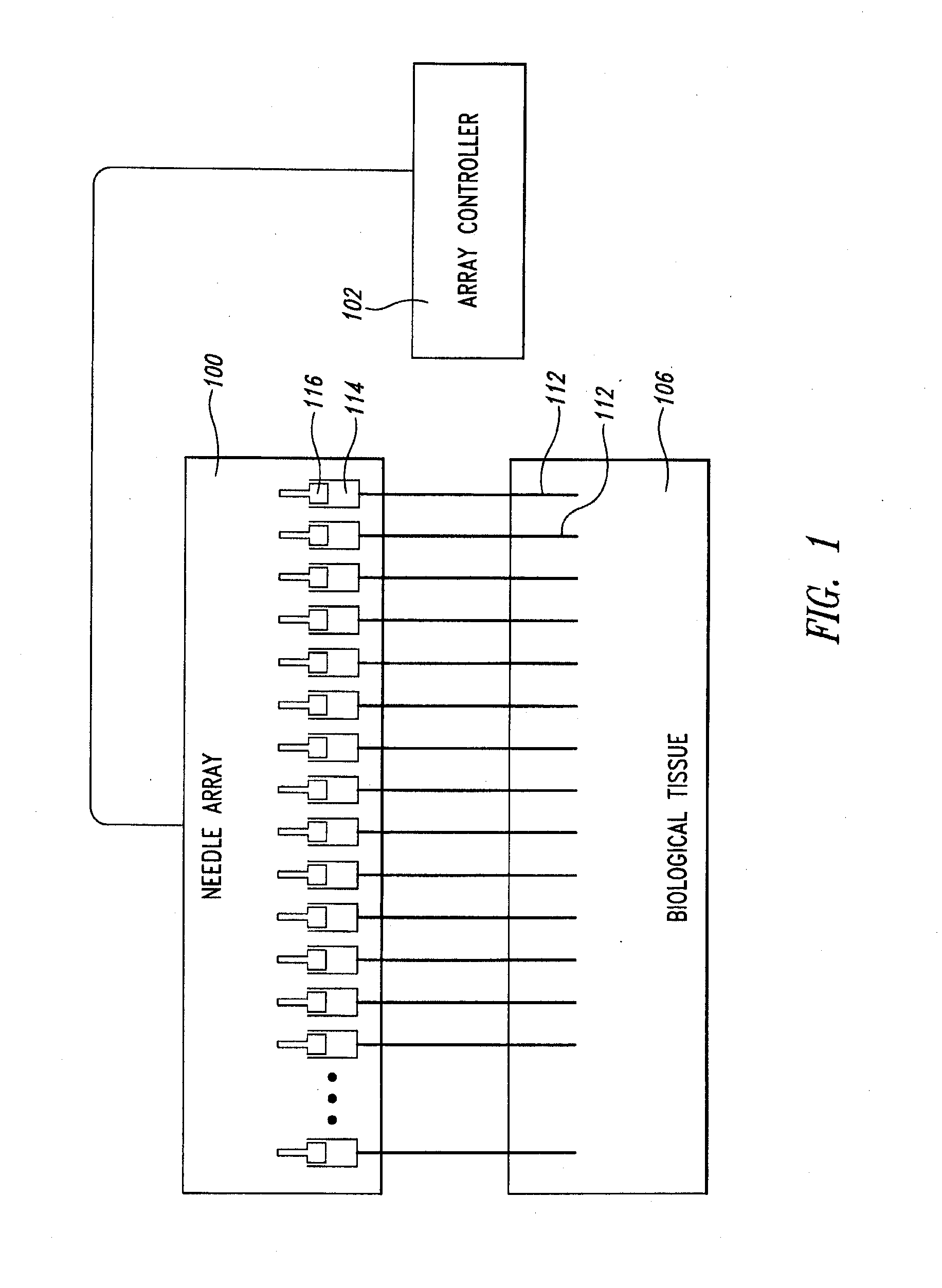 Needle Array Assembly and Method for Delivering Therapeutic Agents