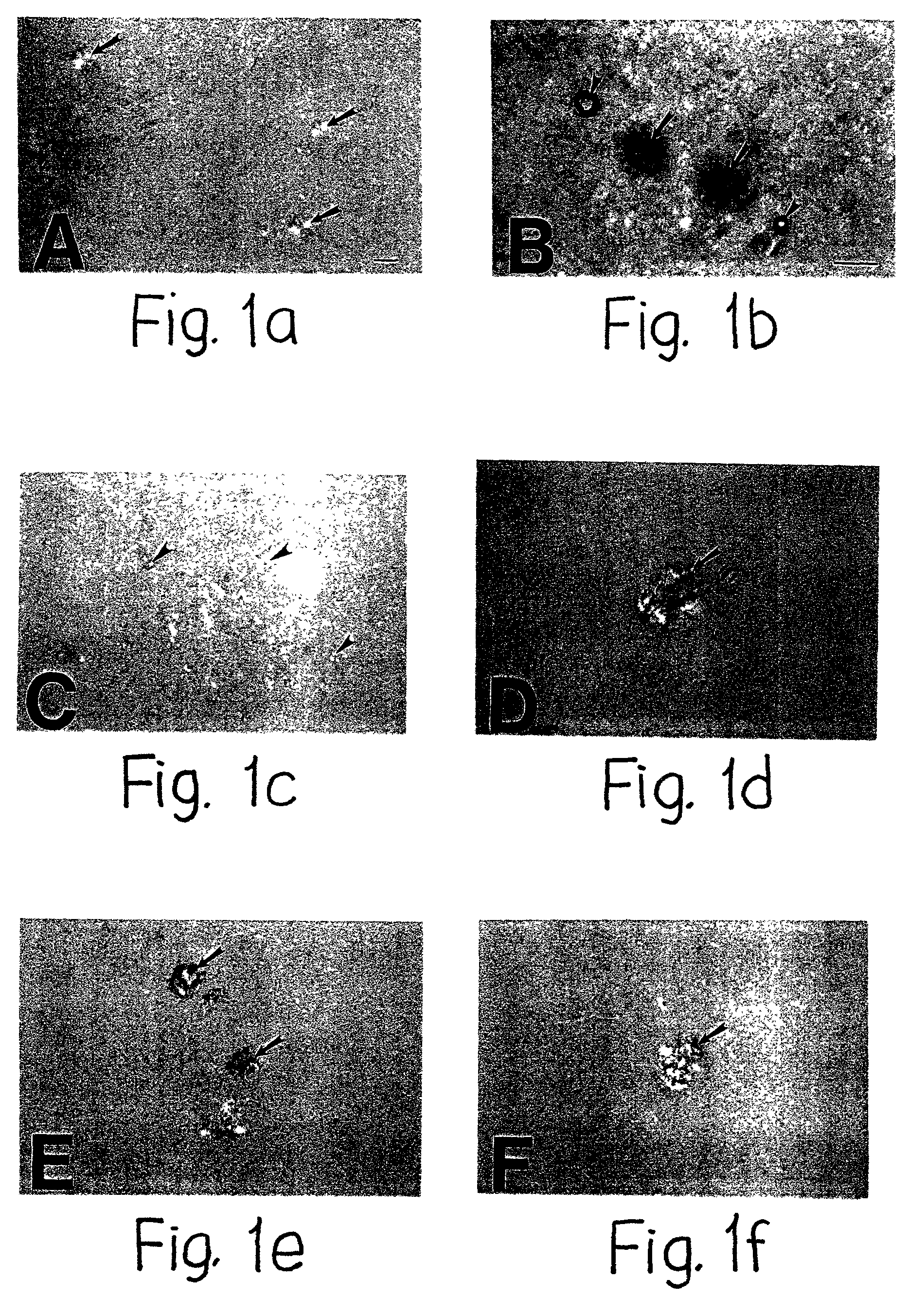 <i>In vitro </i>formation of congophilic maltese-cross amyloid plaques to identify anti-plaque therapeutics for the treatment of Alzheimer's and Prion diseases