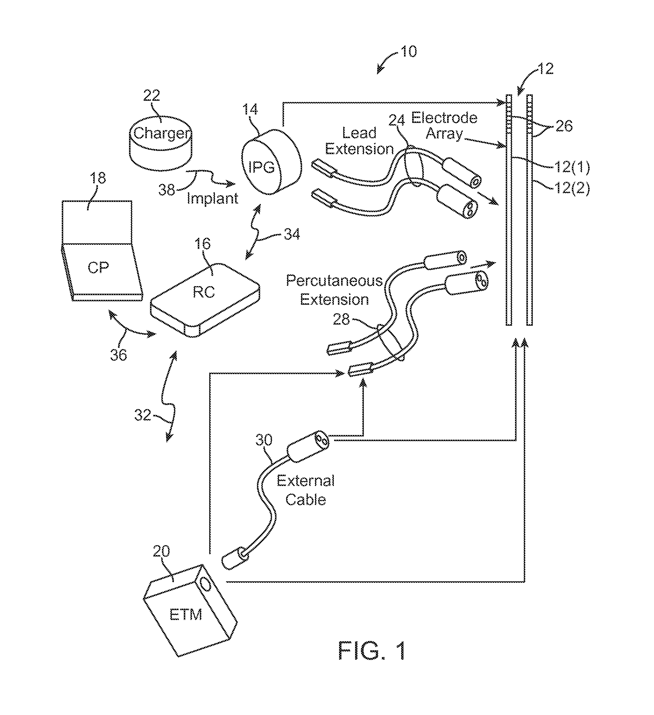 Systems and methods of providing modulation therapy without patient-perception of stimulation