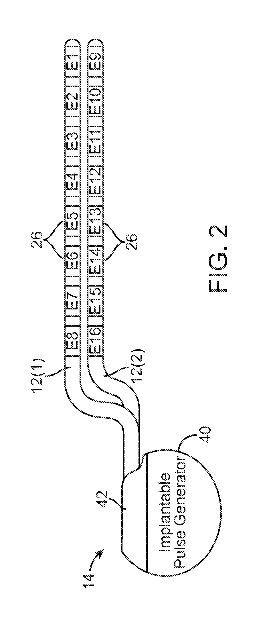 Systems and methods of providing modulation therapy without patient-perception of stimulation