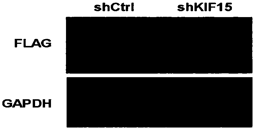 Purpose of KIF15 inhibitor to preparation of liver cancer treatment medicine