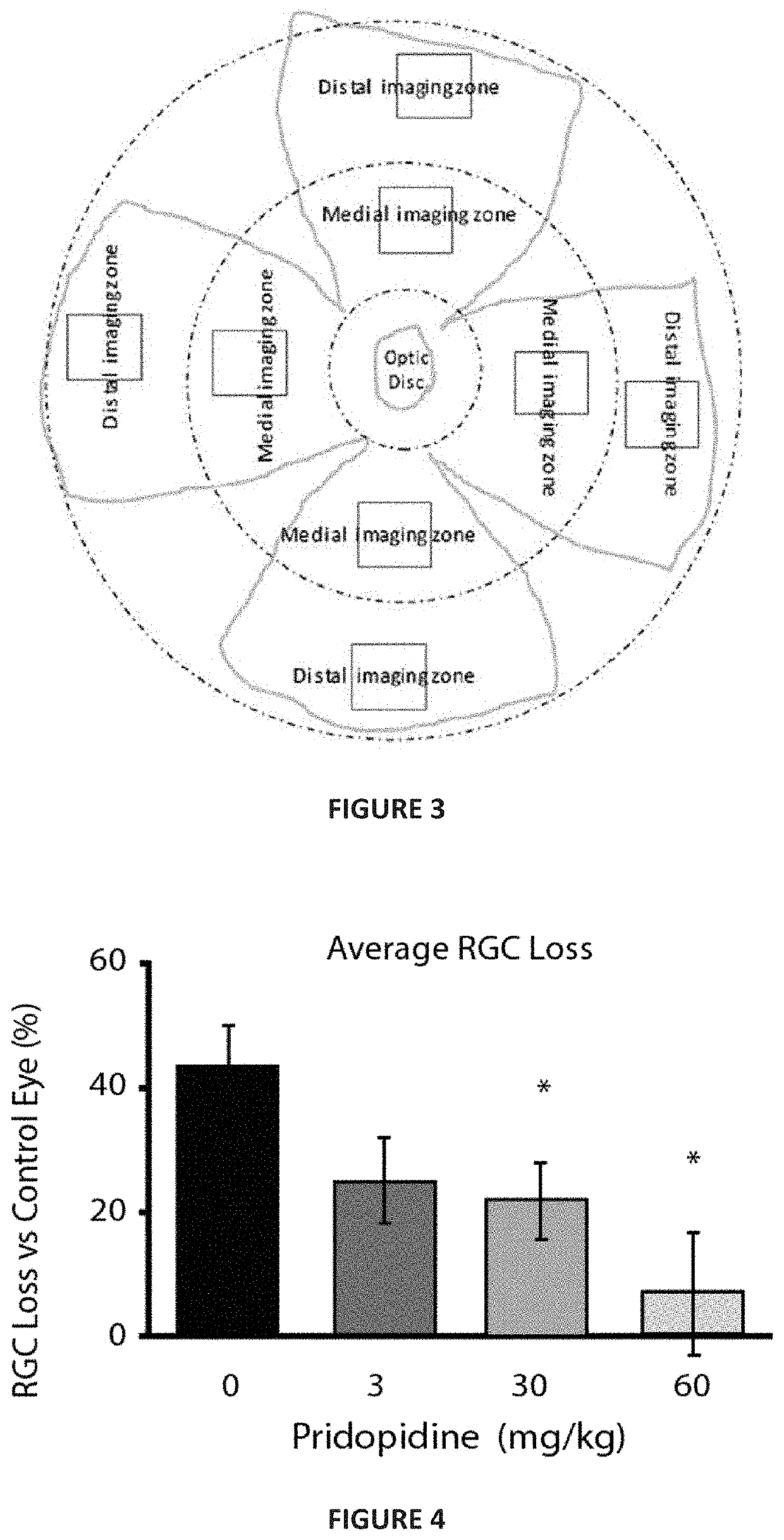 Treatment of neurodegenerative eye disease using pridopidine