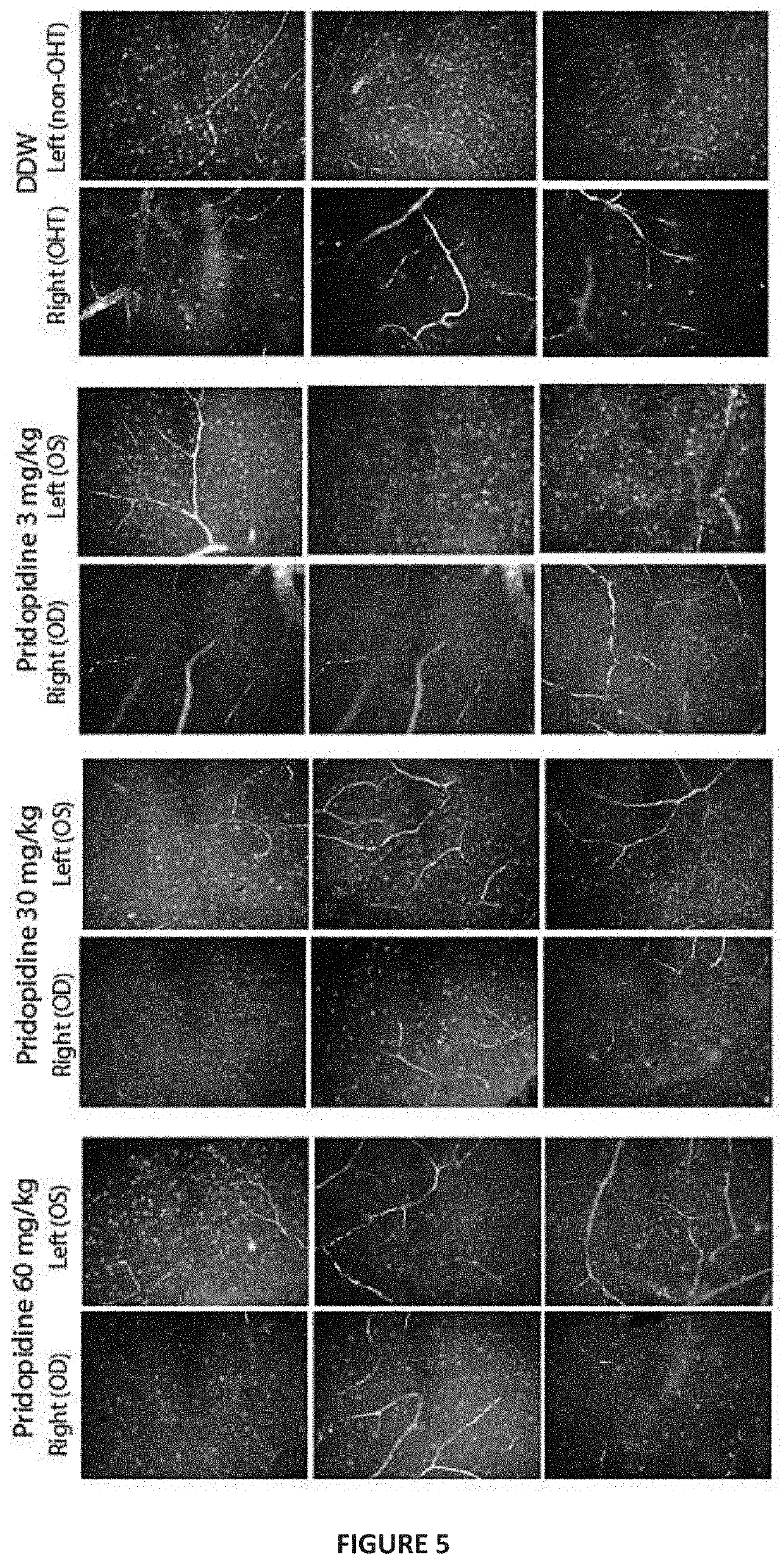 Treatment of neurodegenerative eye disease using pridopidine