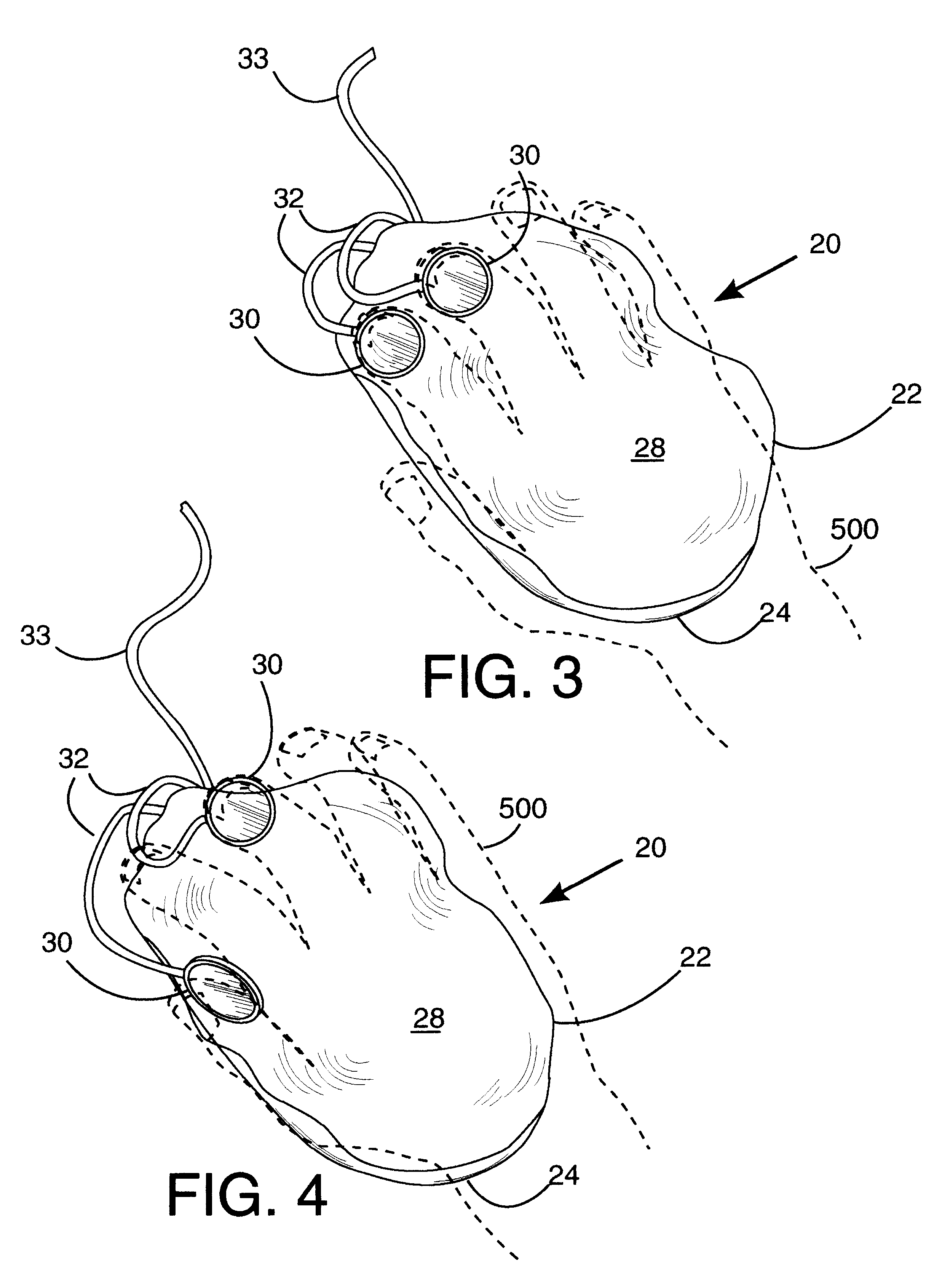 Computer pointing device and method of use
