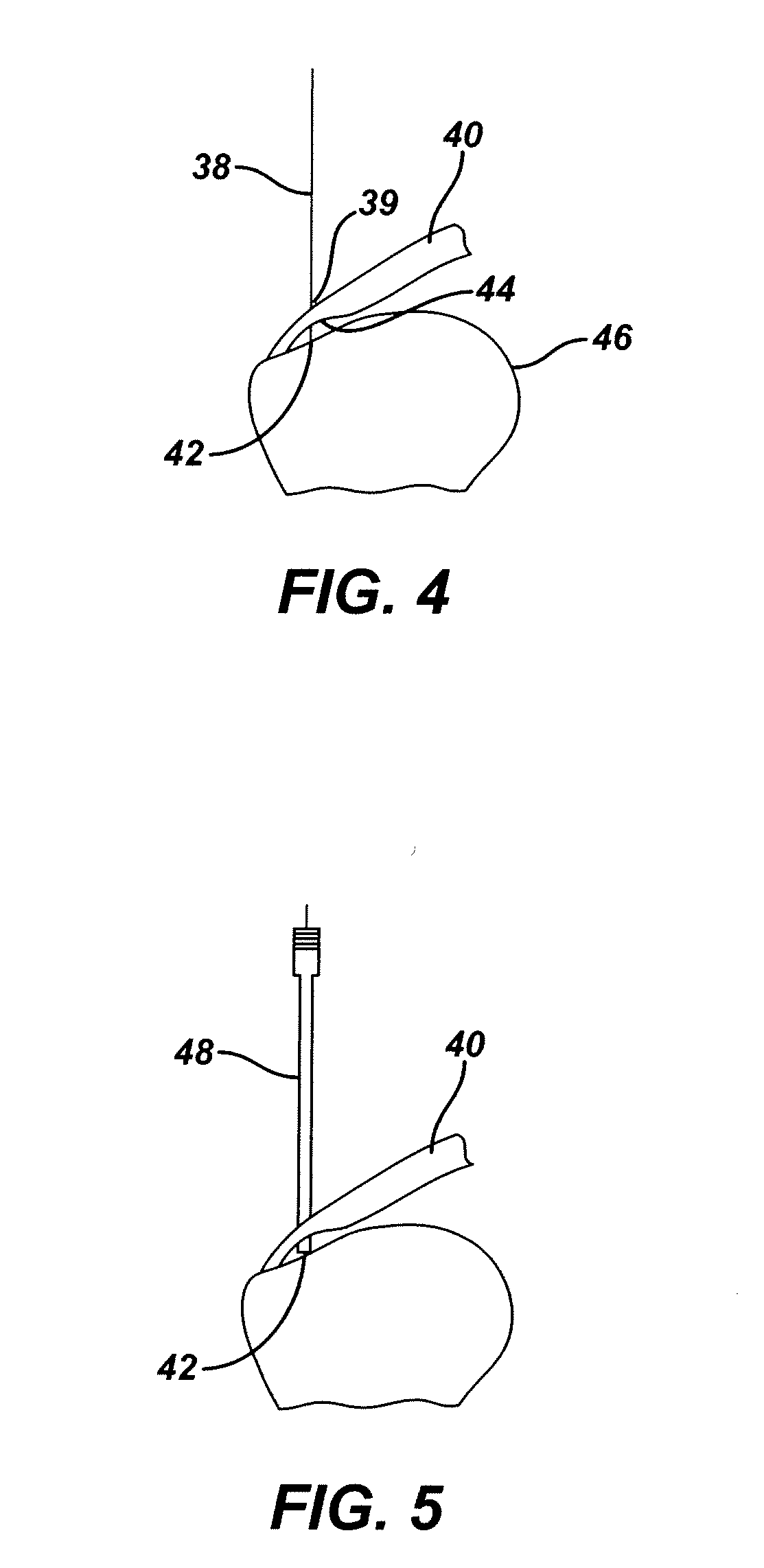 Dual cannula system and method for partial thickness rotator cuff repair