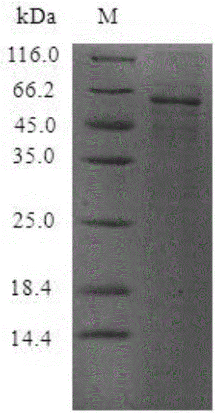 Method for preparing cysteine protease through cell-free protein synthesis system