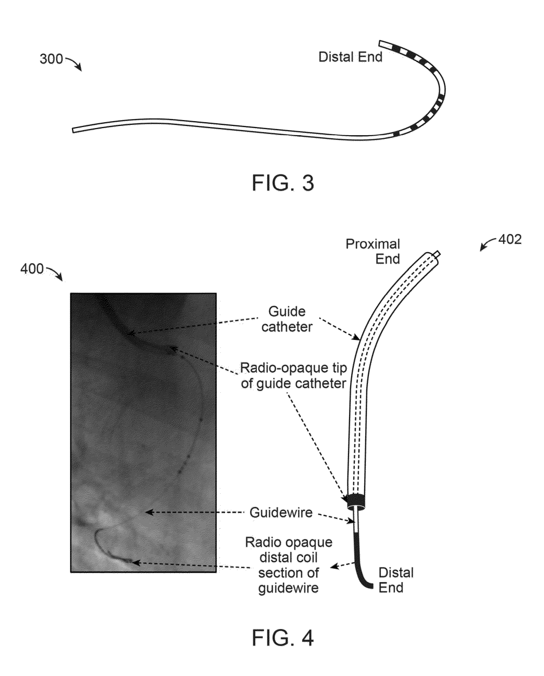 Systems for linear mapping of lumens