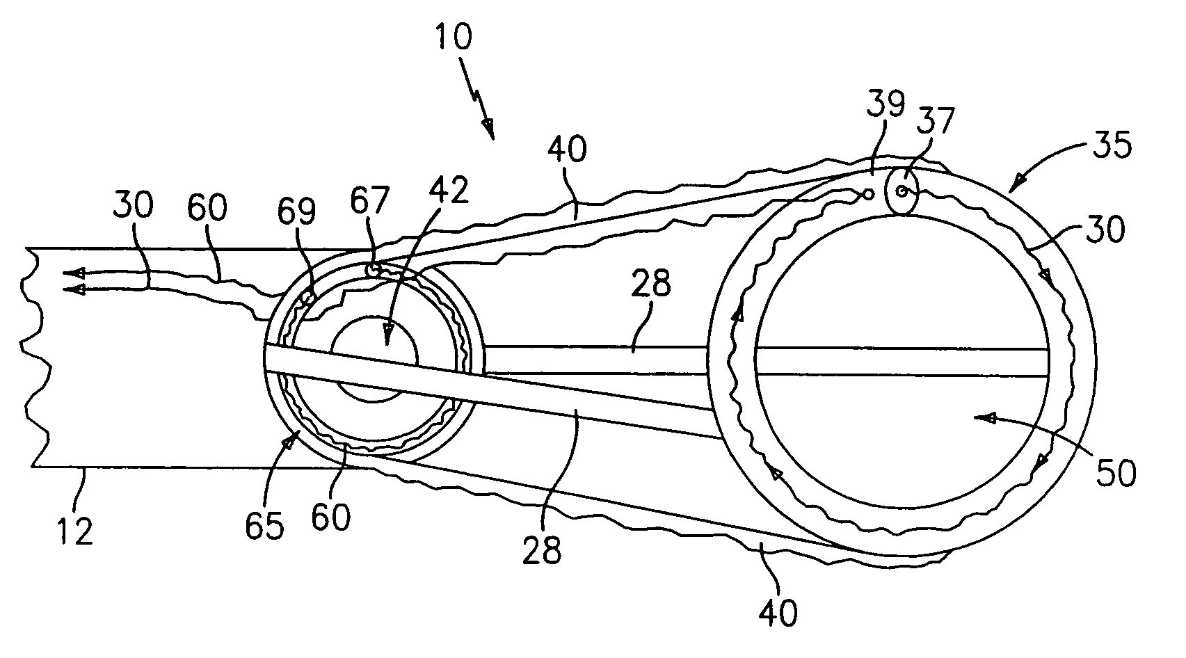 Endoscopic tissue removal apparatus and method