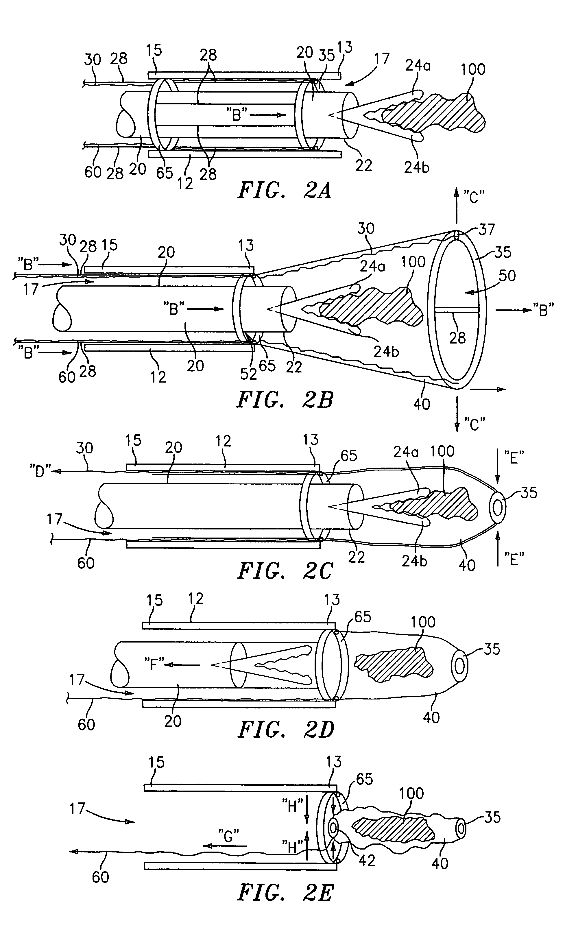 Endoscopic tissue removal apparatus and method
