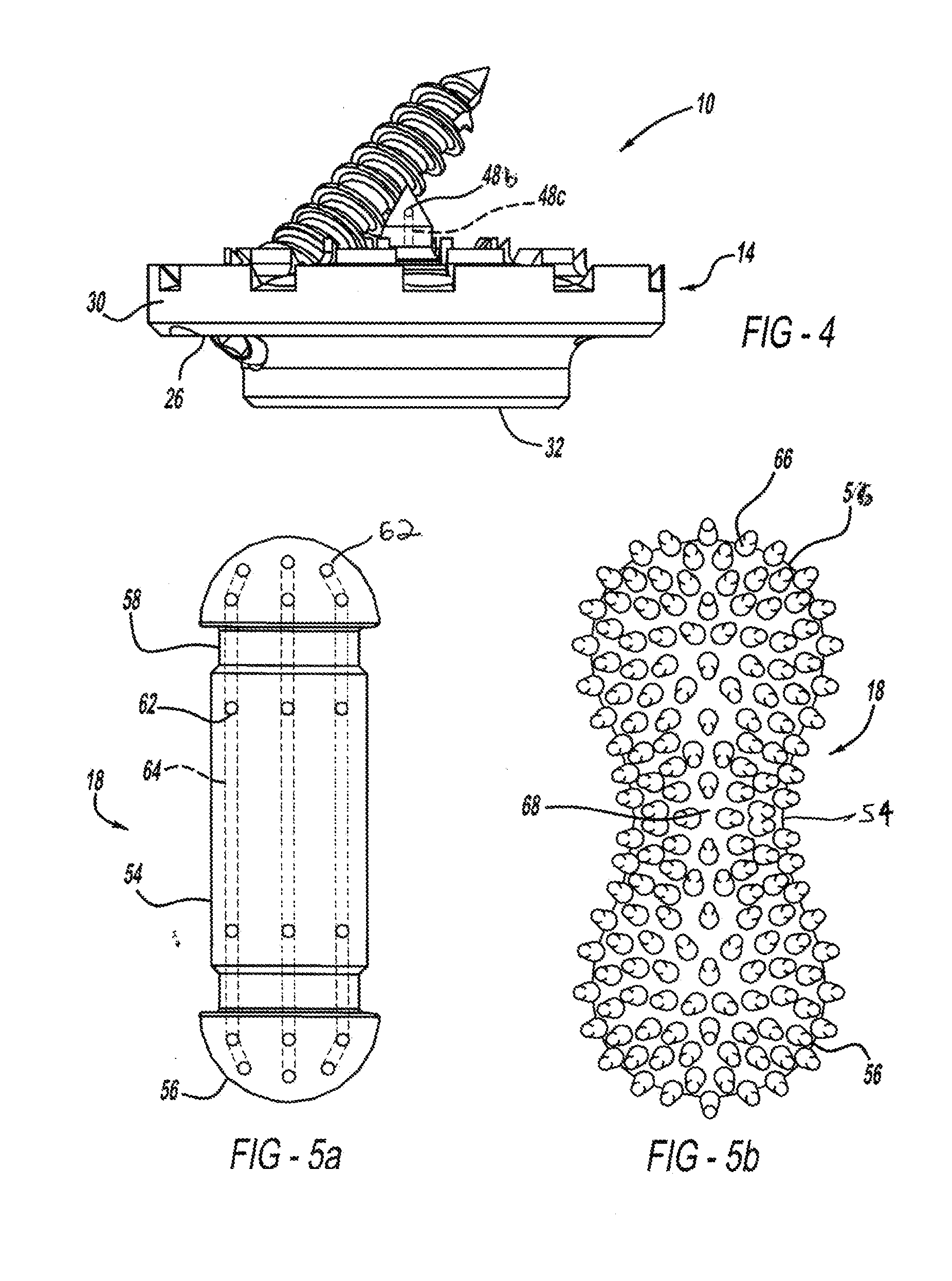 Method and implant device for grafting adjacent vertebral bodies