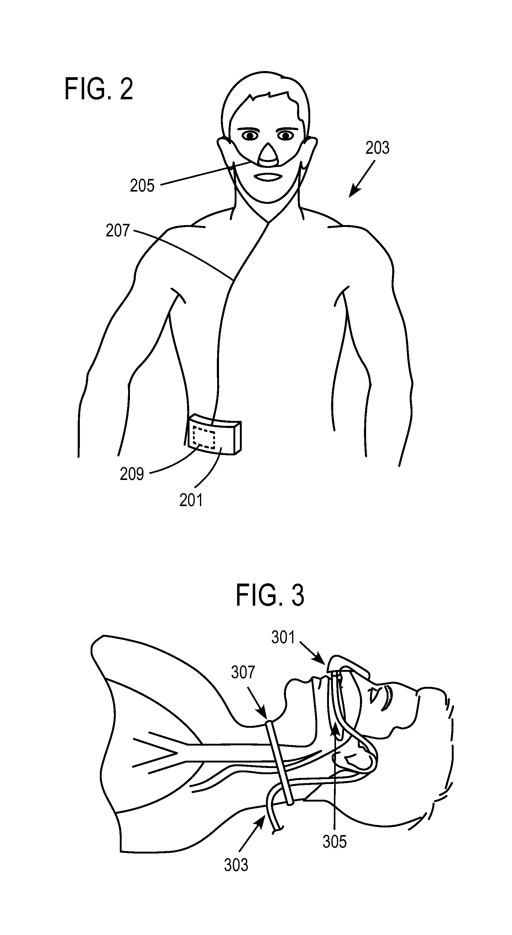 Methods, systems and devices for non-invasive open ventilation for treating airway obstructions