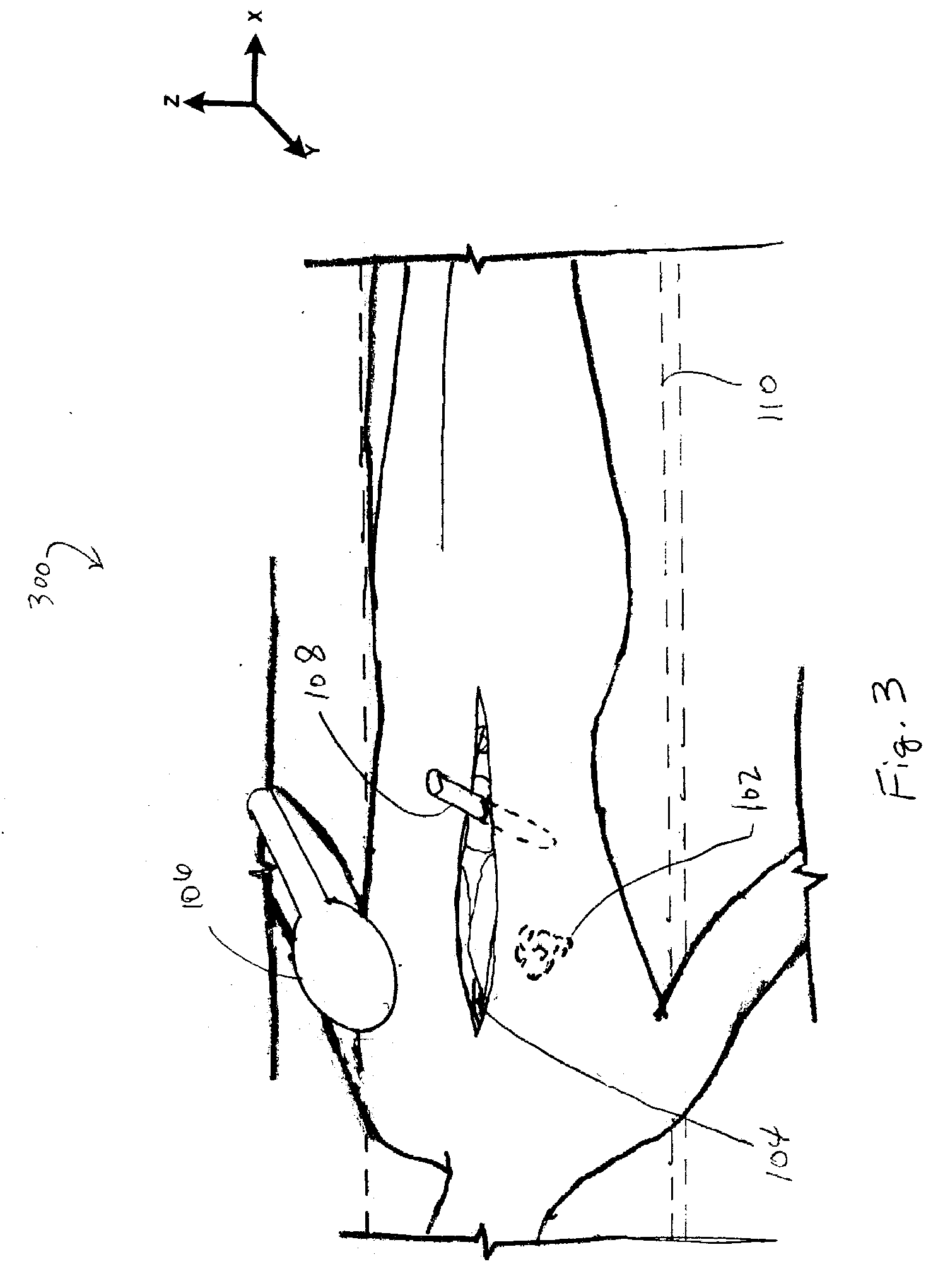 Medical surgical sponge and instrument detection system and method