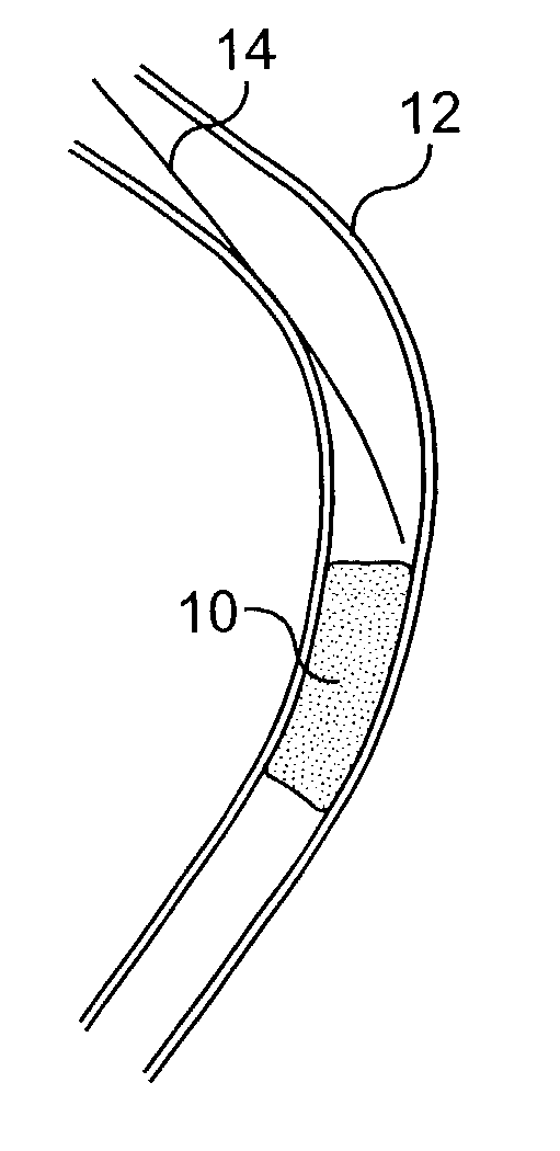 Guide wire control catheters for crossing occlusions and related methods of use