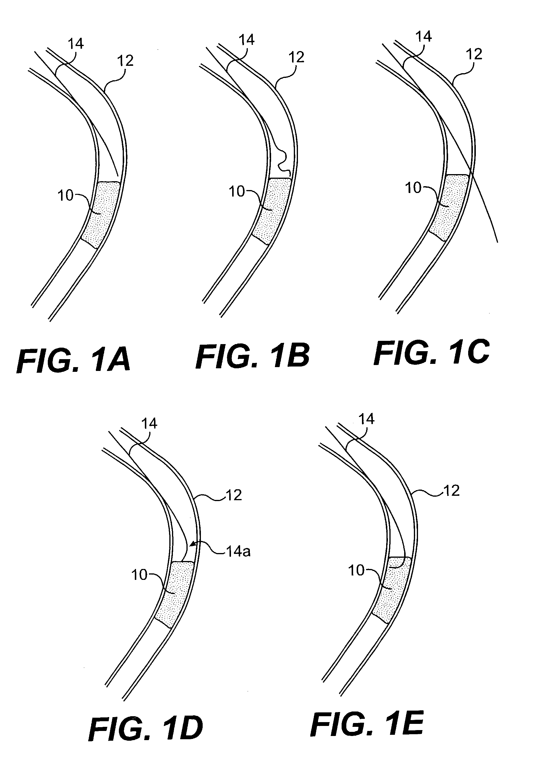 Guide wire control catheters for crossing occlusions and related methods of use