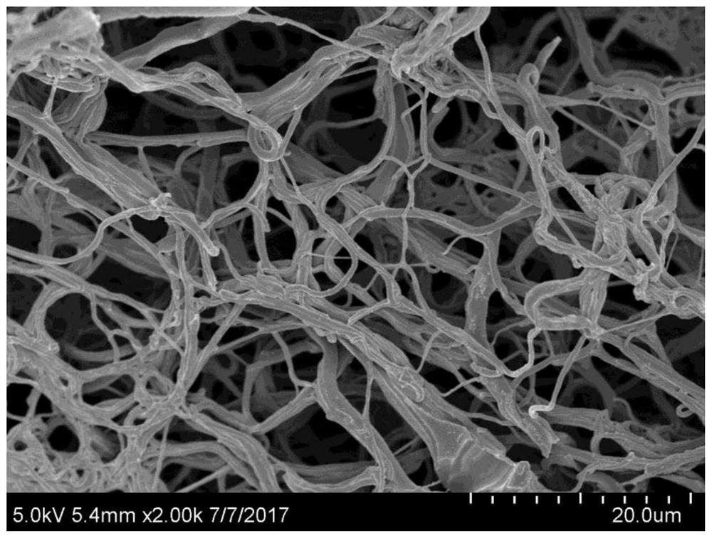 A kind of hygroscopic antibacterial 3D nanofiber medical dressing and preparation method thereof