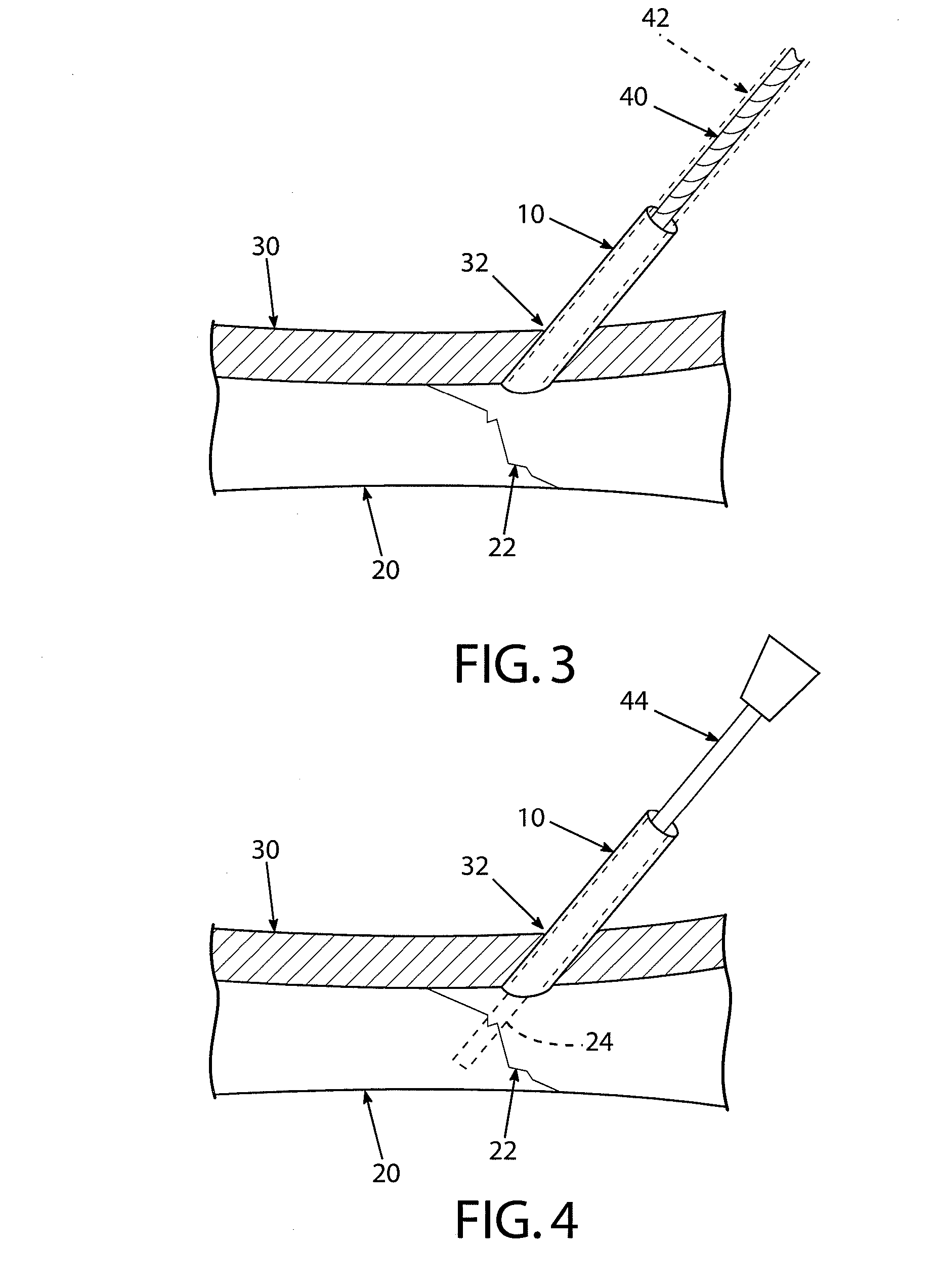 Bone screw introducing sleeve