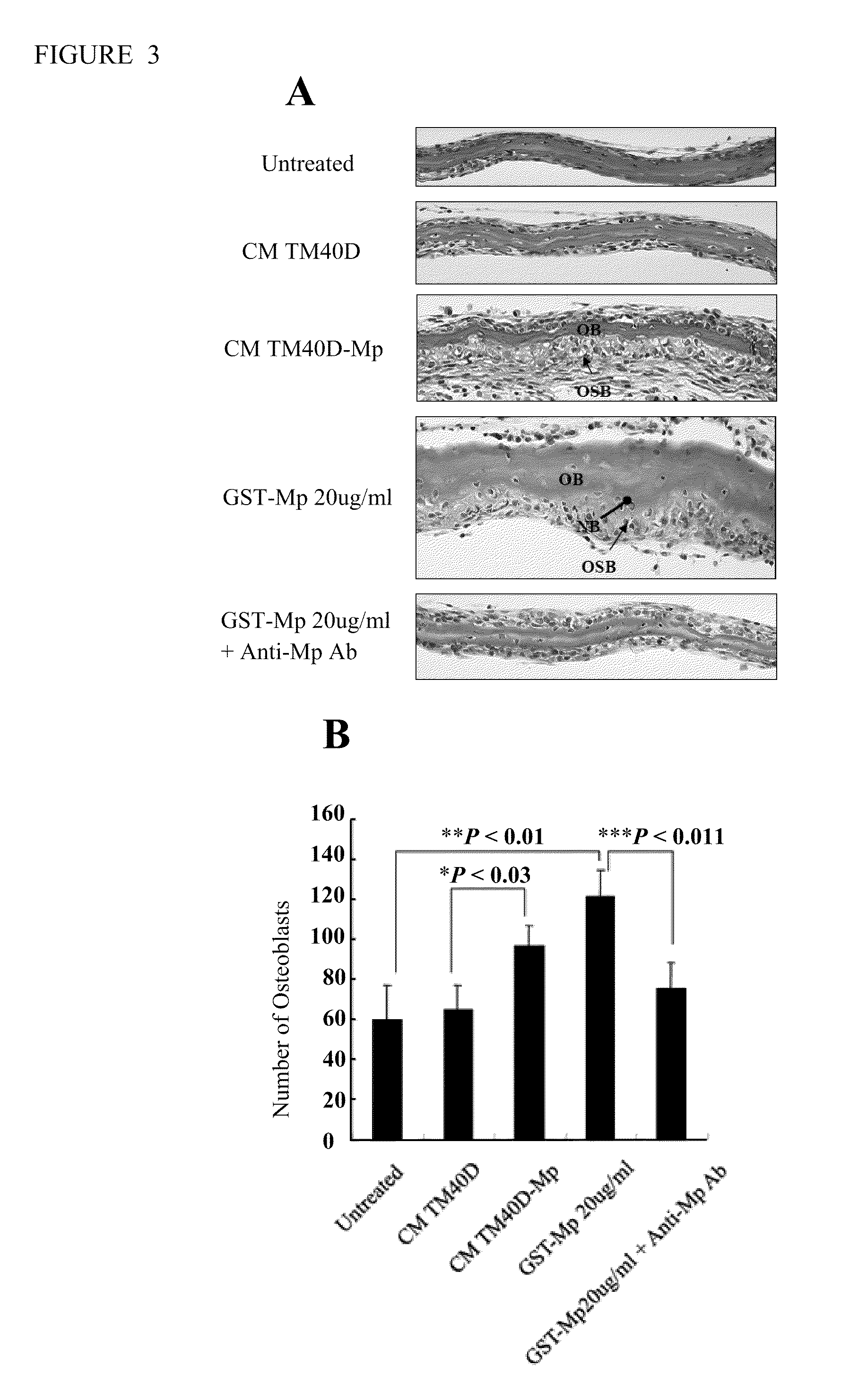 Compositions and Methods For Treating Bone Formation Disorders