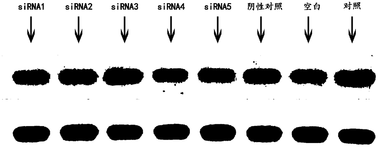 siRNA capable of inhibiting expression of HSP90 gene in breast cancer cells