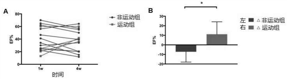 Application of hdac4 inhibitor in preparation of medicine for treating heart failure