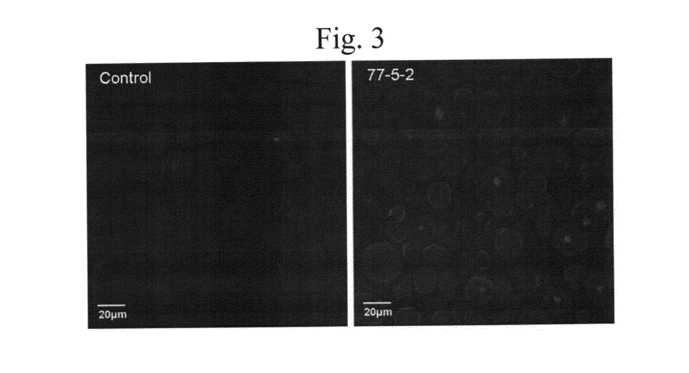 Soybean derived human thyroglobulin, methods of producing and applications thereof