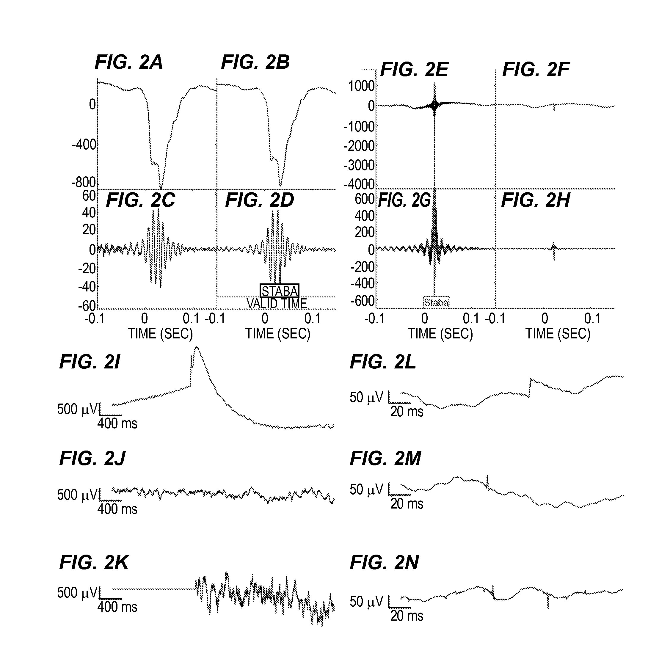 Automated detector and classifier of high frequency oscillations and indicator seizure onset