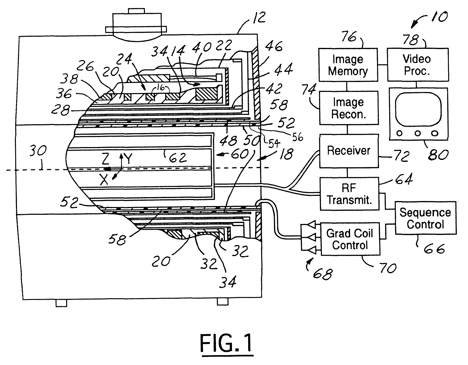 Superconducting magnet coil support structure
