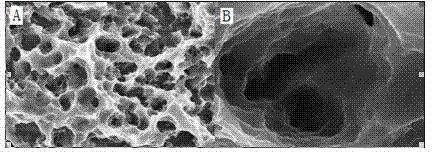 Preparation method of titanium implant surface with micro-nano composite structure