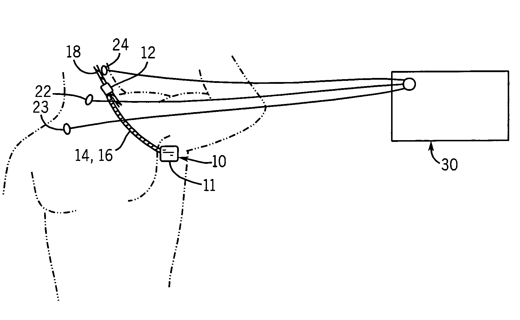 Method and apparatus for detecting vagus nerve stimulation