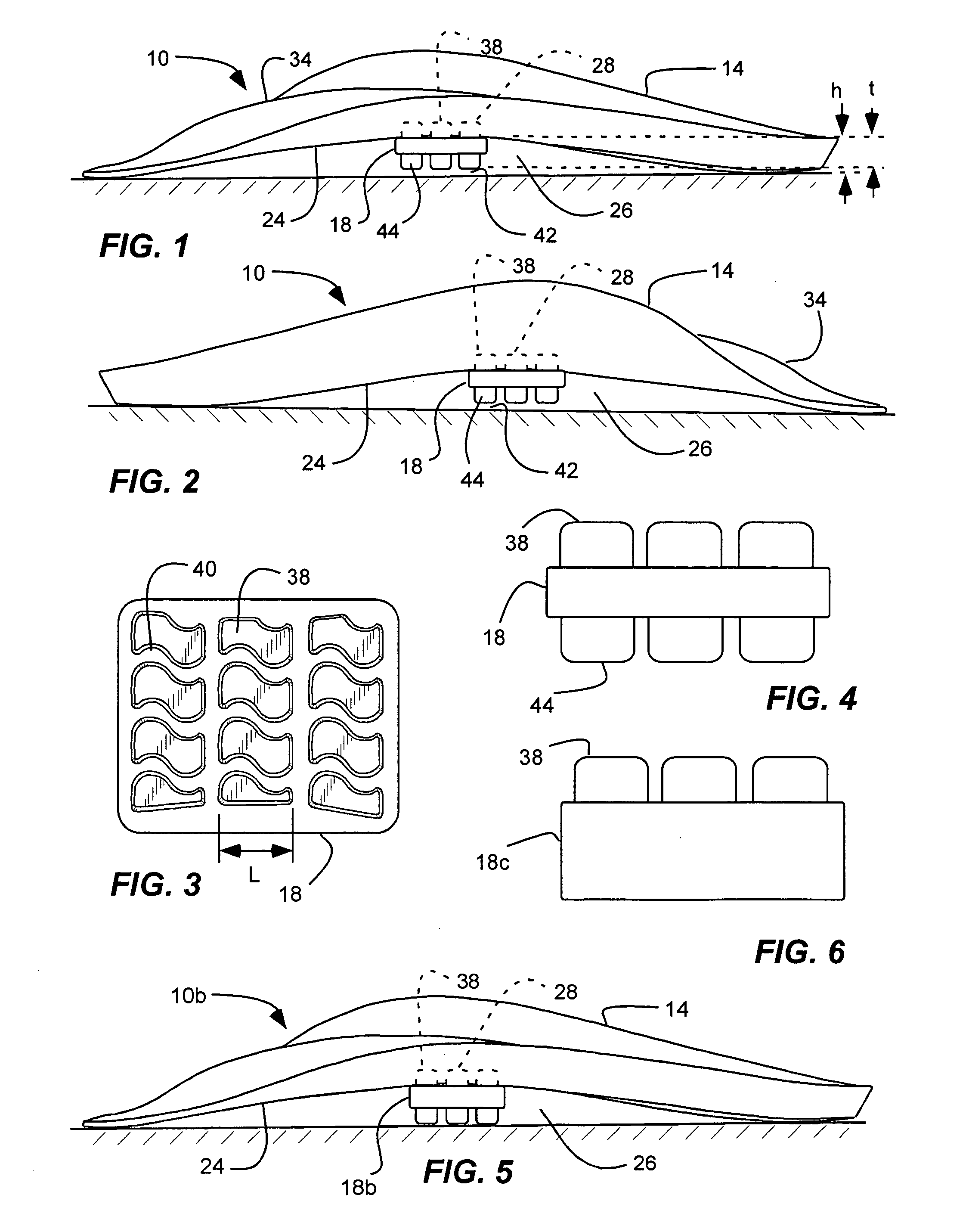 Arch support reinforcement device