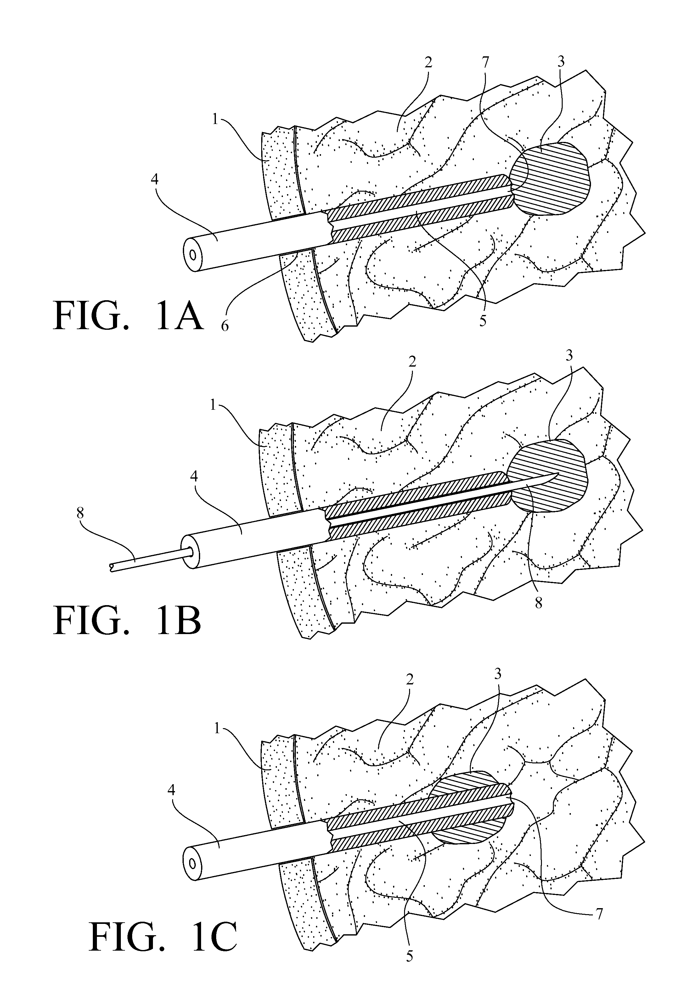Interstitial ultrasonic disposable applicator and method for tissue thermal conformal volume ablation and monitoring the same