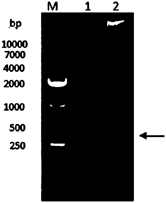 Preparation and application of echovirus type 9 vp1 protein specific antigenic epitope and its fusion protein