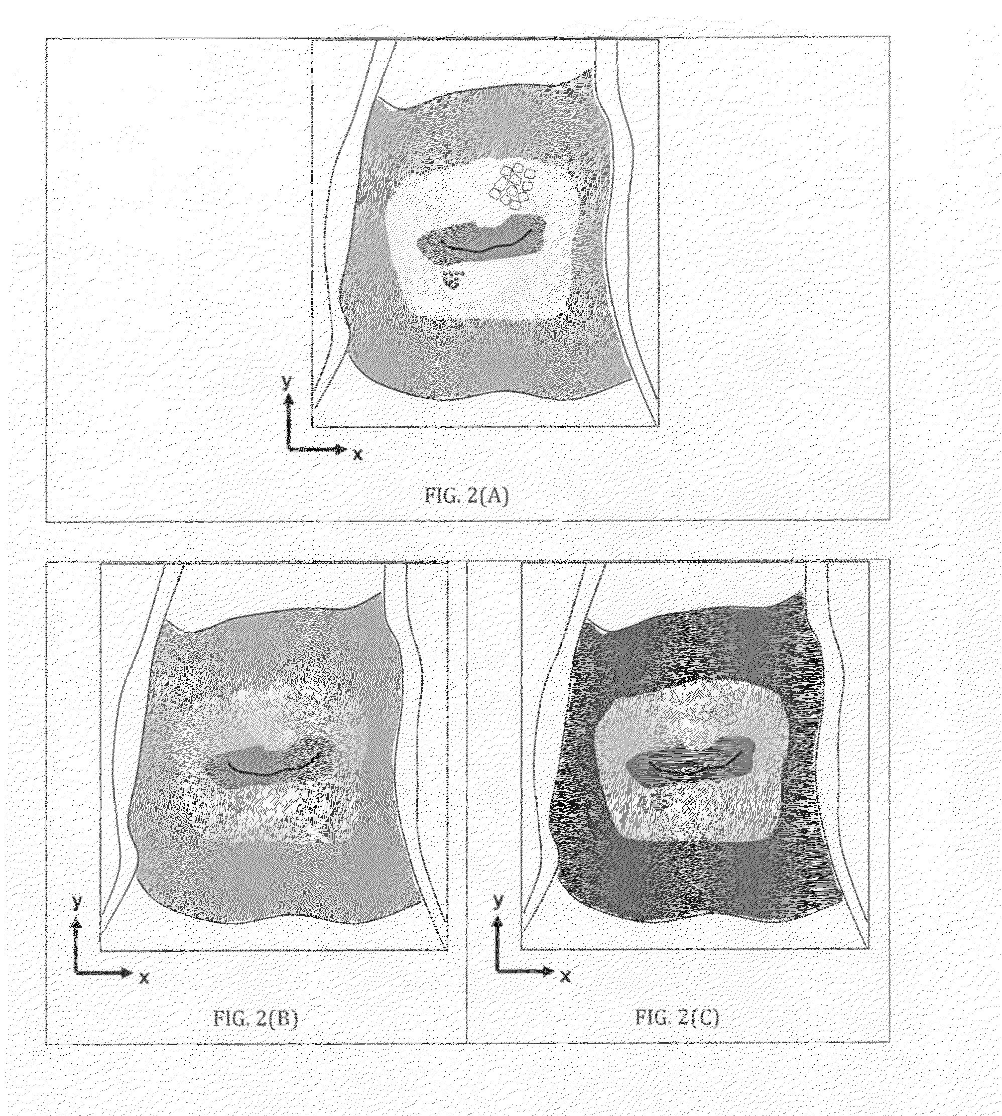 Process for preserving three dimensional orientation to allow registering histopathological diagnoses of tissue to images of that tissue