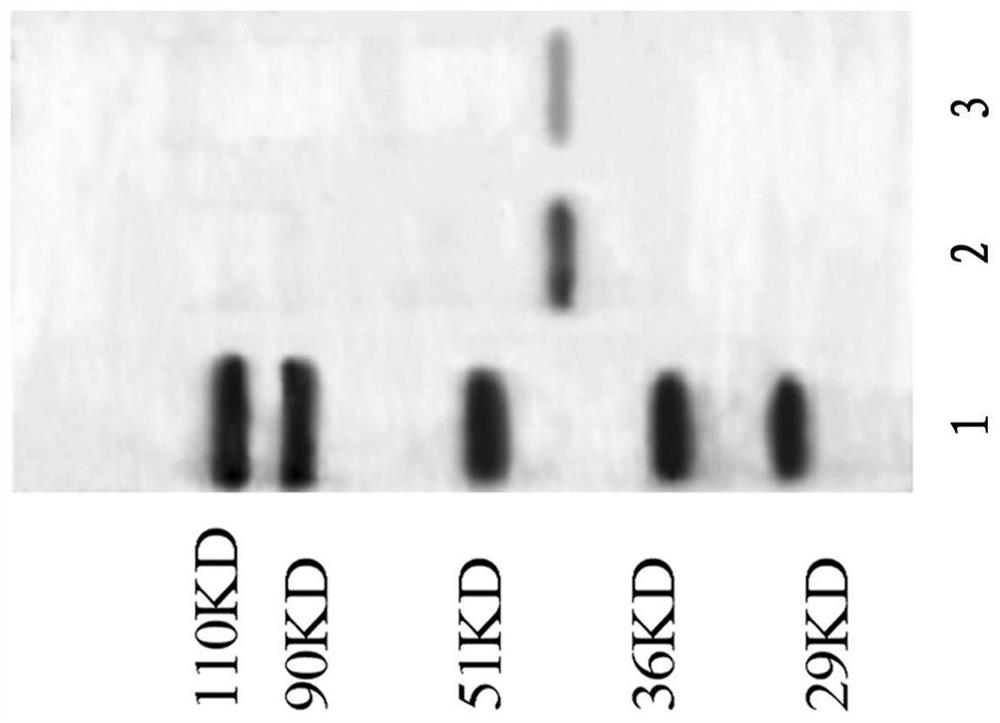 Human target complement inhibitor protein mcr2-cd59 and its application