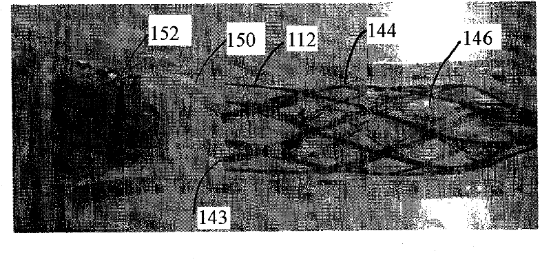 Flow restoration systems and methods for use