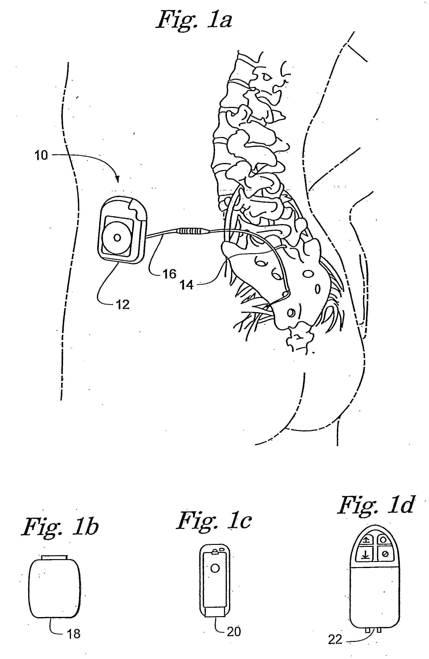 Implantable medical device configured for diagnostic emulation