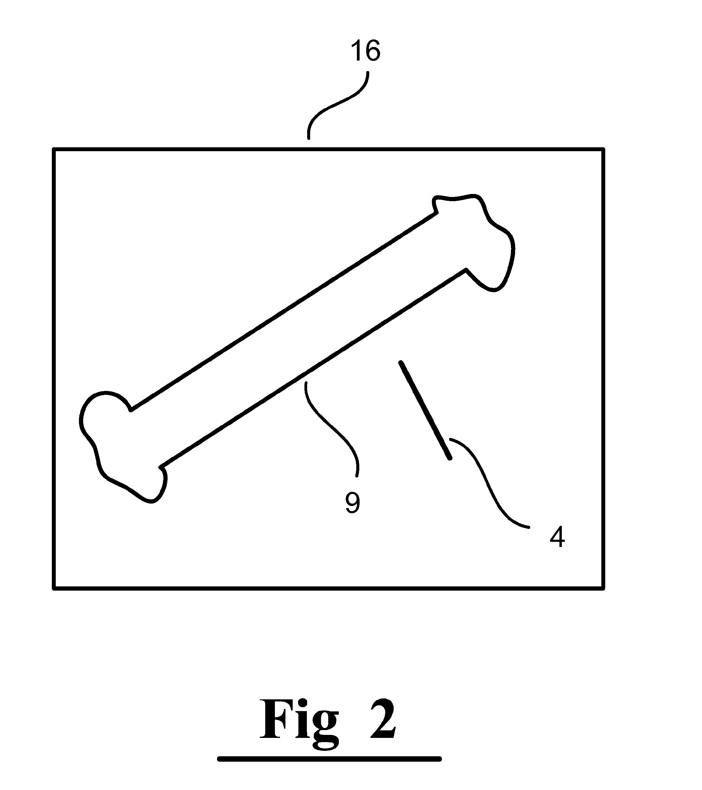 Methods, Devices, Systems, Circuits and Associated Computer Executable Code for Detecting and Predicting the Position, Orientation and Trajectory of Surgical Tools