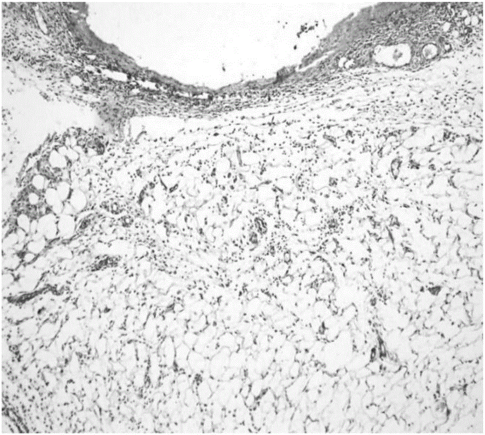 Biological material applied to operative skin incision and infectious and non-infectious wound surfaces and application thereof