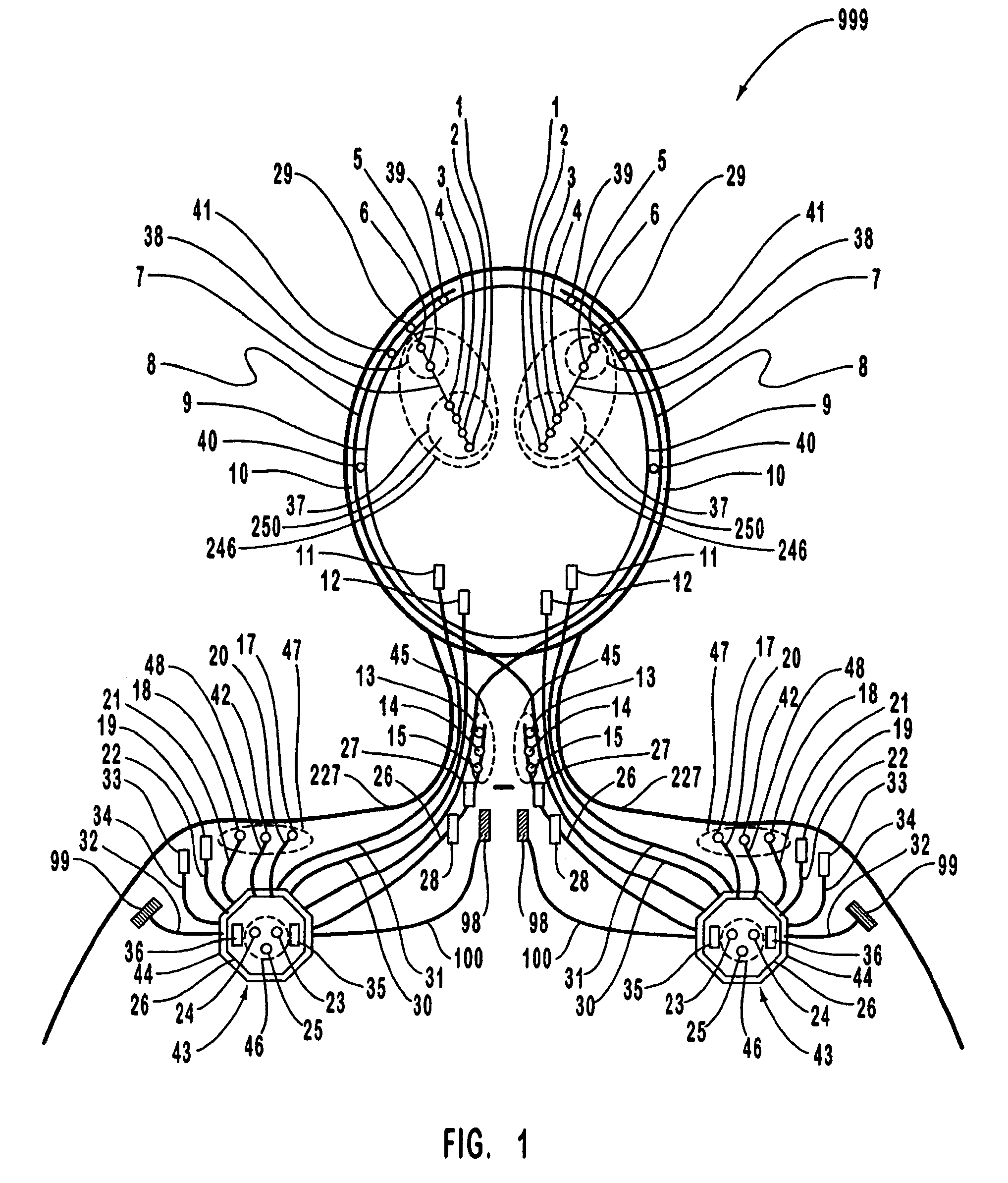 Systems and methods for monitoring a patient's neurological disease state