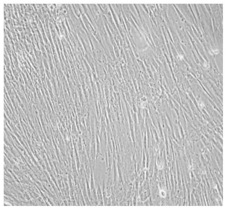A kind of medium for inducing adipogenic differentiation of skeletal muscle myogenic stem cells and its application and adipogenic differentiation method