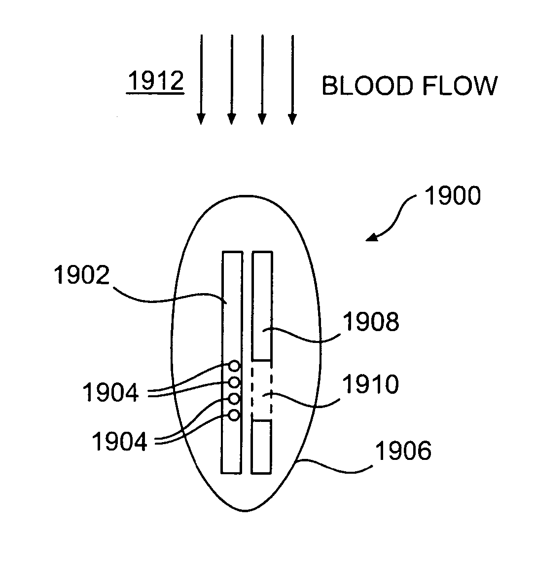 Implantable device for telemetric measurement of blood pressure/temperature within the heart