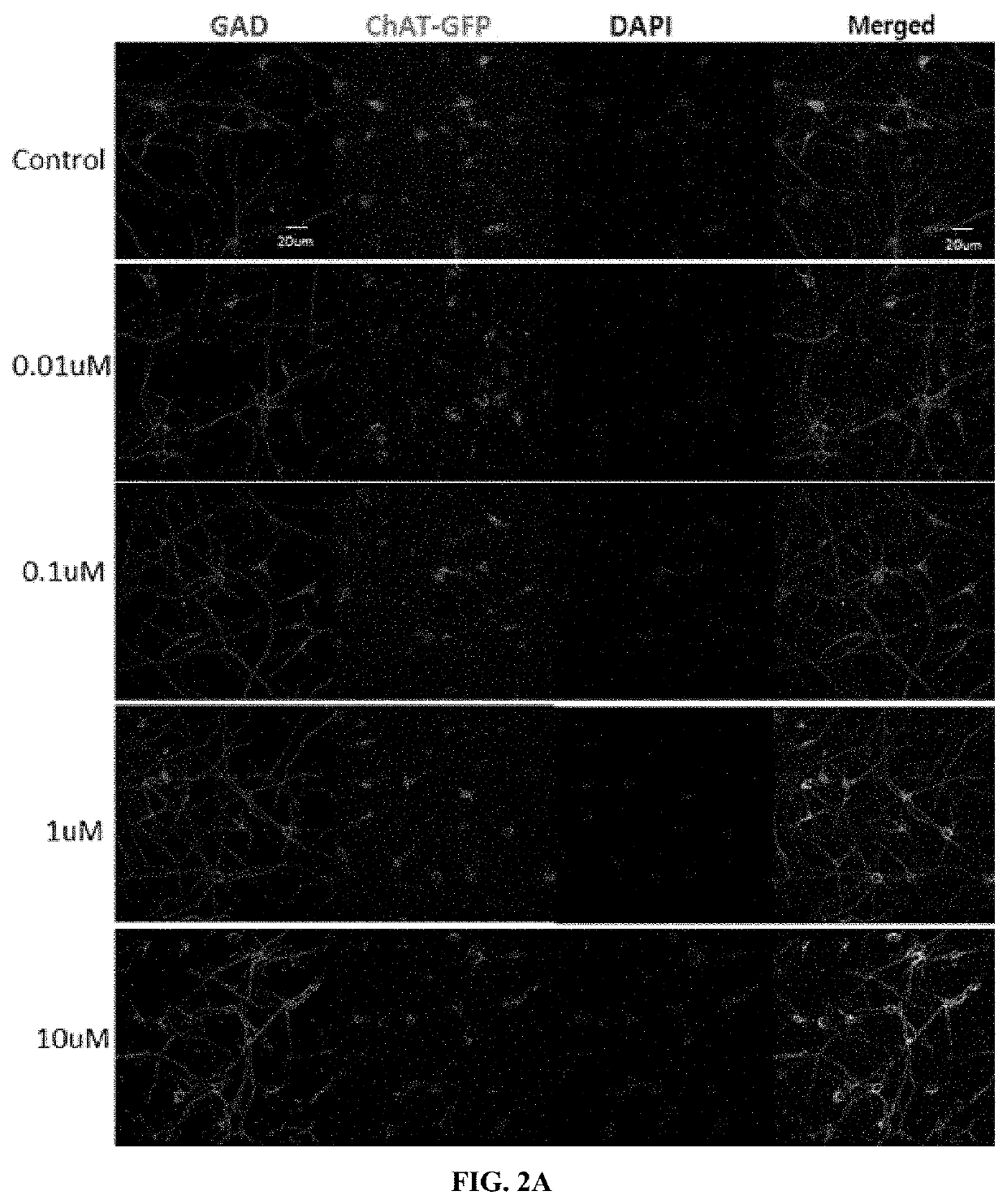 Composition for preventing or treating neurological disorder comprising aucubin