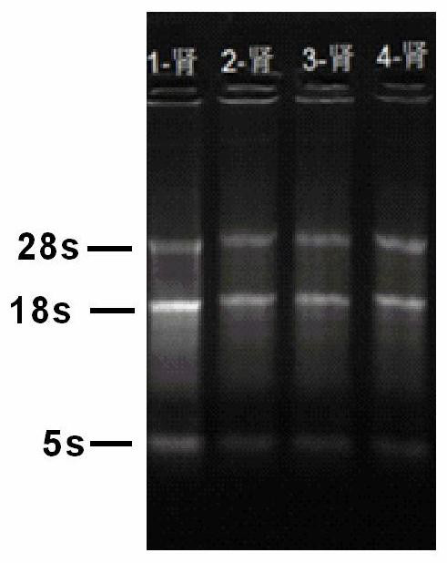 RT-qPCR detection method of slc2a9/glut9 gene transcription level in macaques