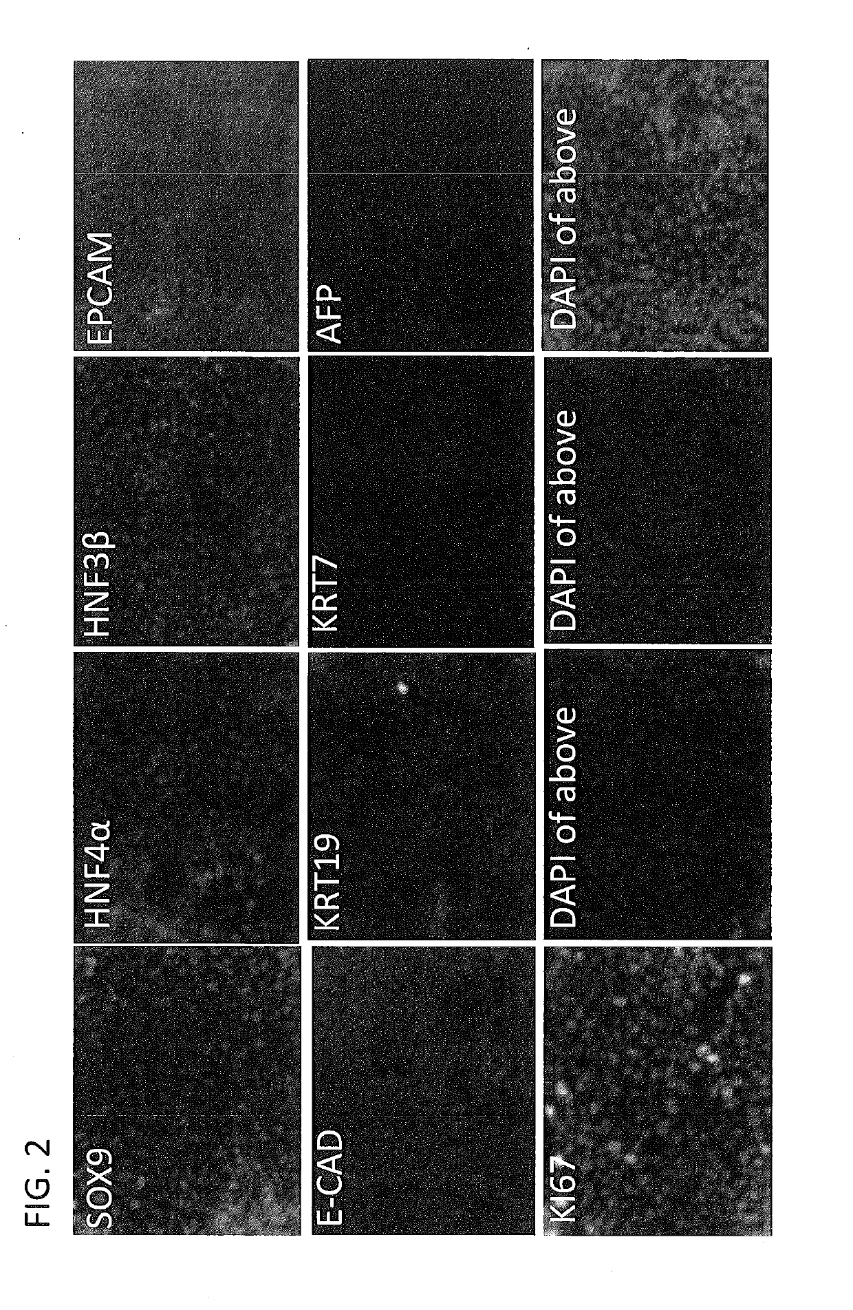 Derivation of hepatic stem cells and mature liver cell types and uses thereof
