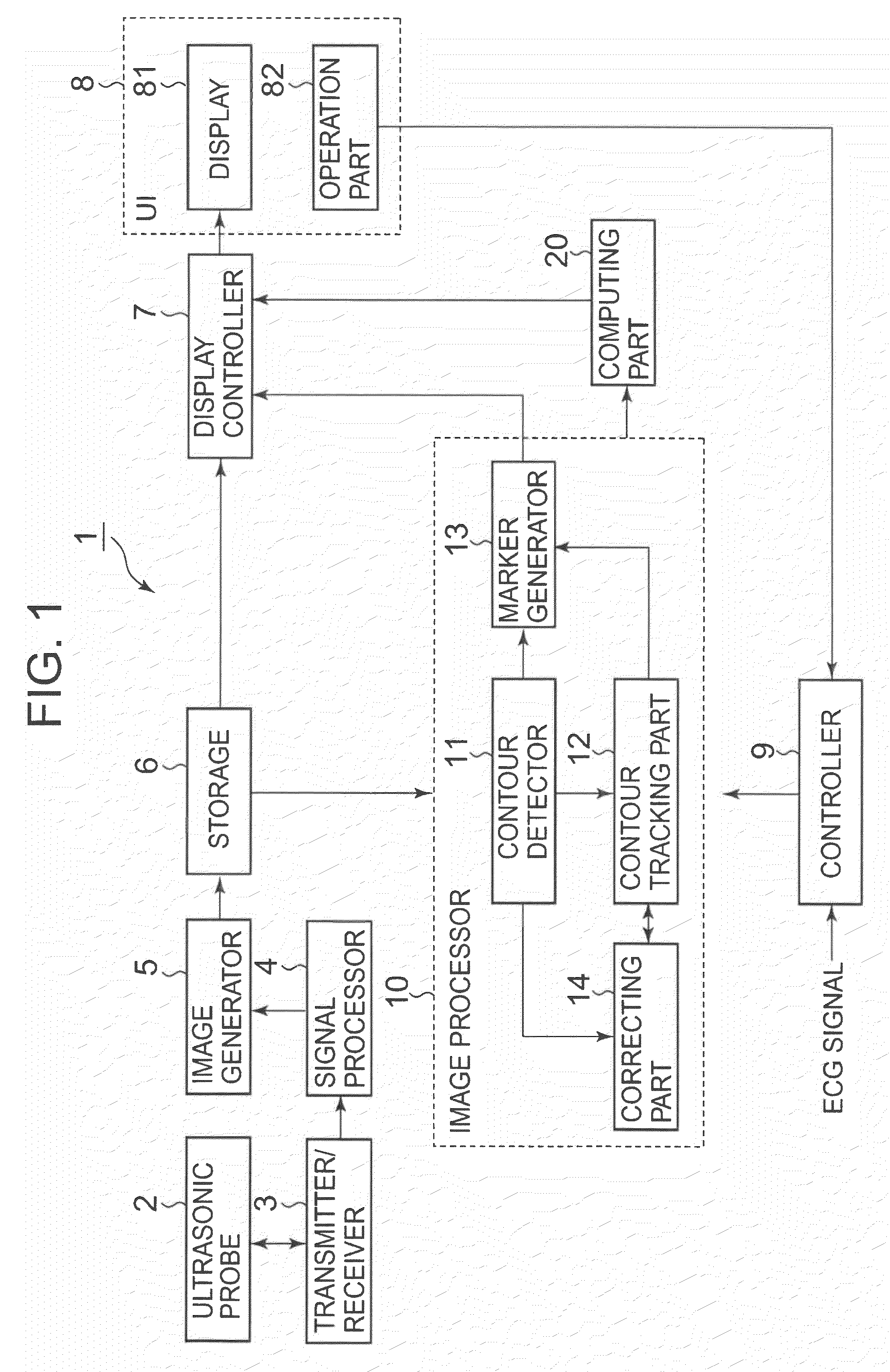 Ultrasonic image processing apparatus and method for processing ultrasonic image