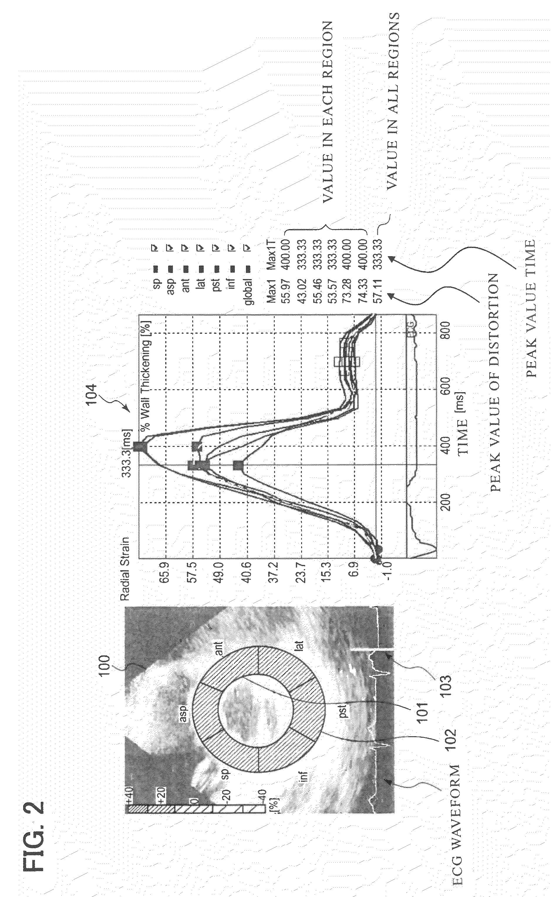 Ultrasonic image processing apparatus and method for processing ultrasonic image