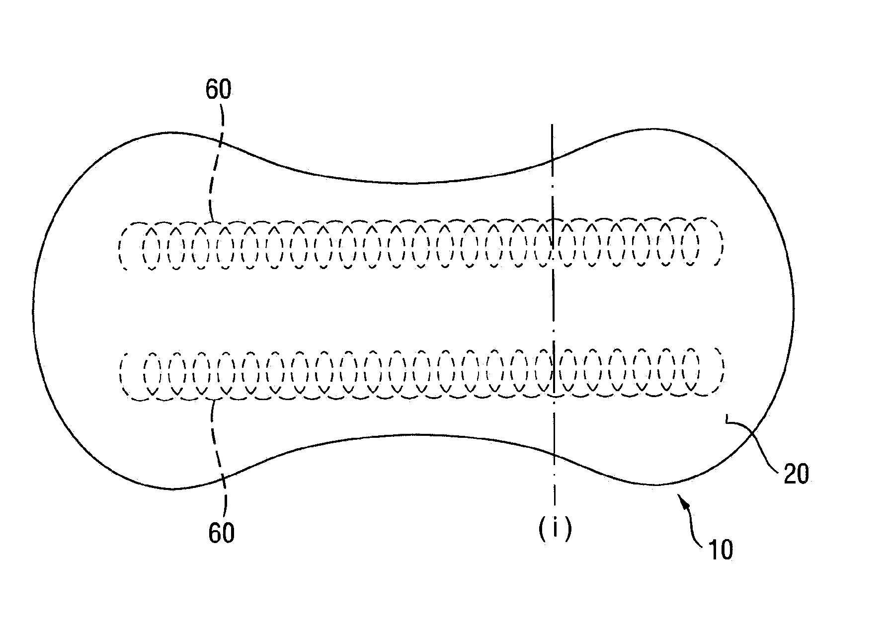 Absorbent articles comprising an odour control system