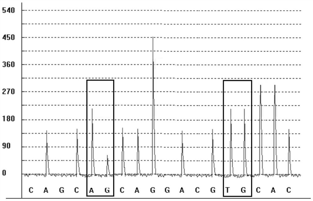 Detection kit for daunorubicin metabolism marker and detection method and application thereof