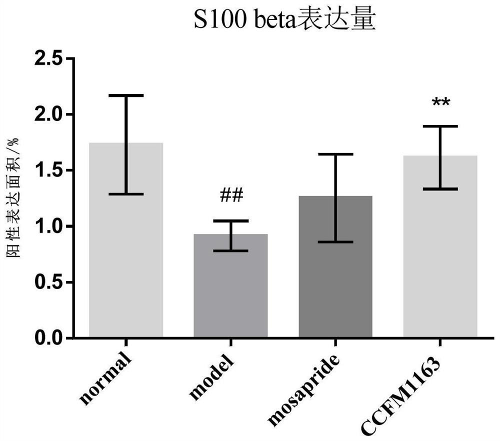 Bifidobacterium bifidum for relieving diarrhea colon and application of bifidobacterium bifidum