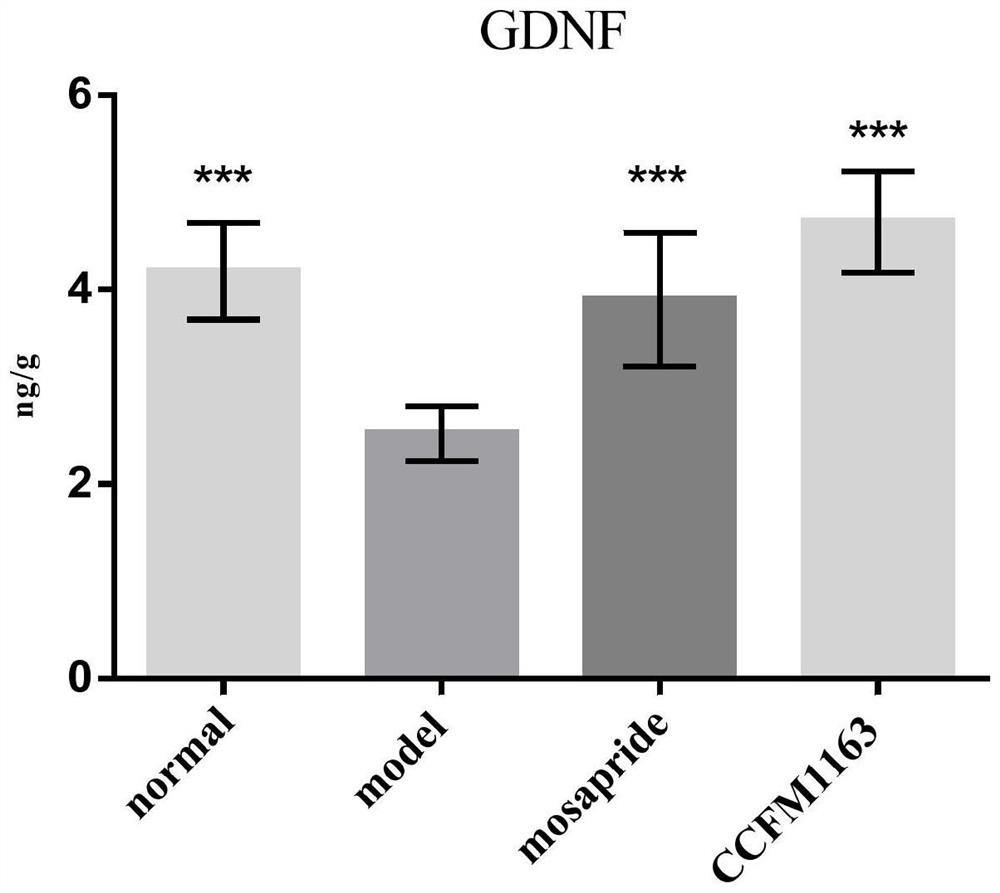 Bifidobacterium bifidum for relieving diarrhea colon and application of bifidobacterium bifidum